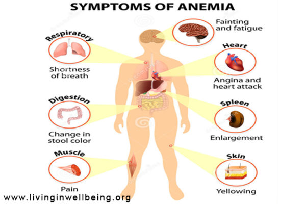 Some Early Signs & Symptoms of Anaemia - Living In Well Being